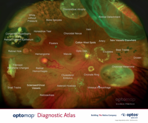 Optomap diagnostics